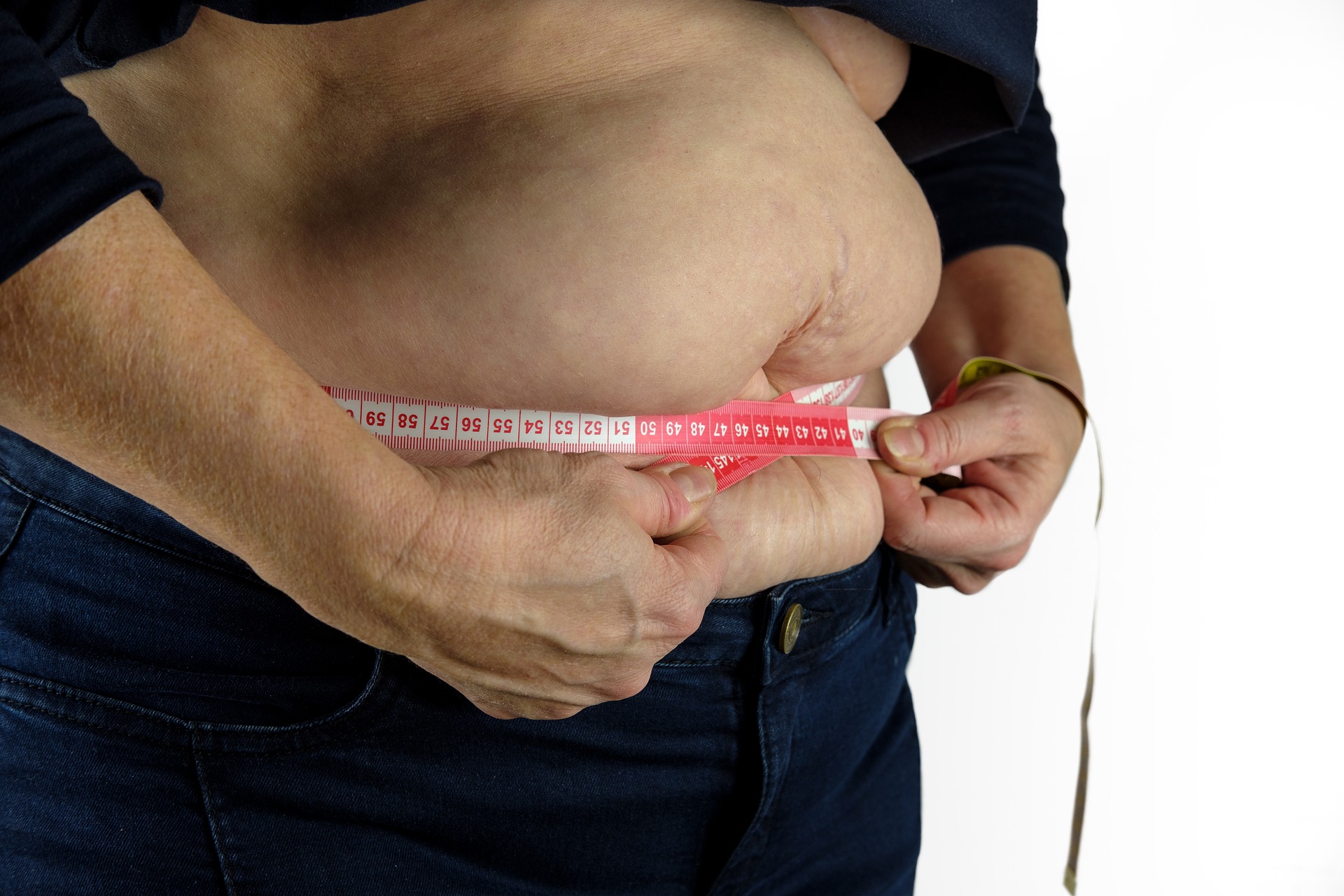 Read more about the article Fatfobia — stygmatyzacja otyłości, która nie ma nic wspólnego z troską